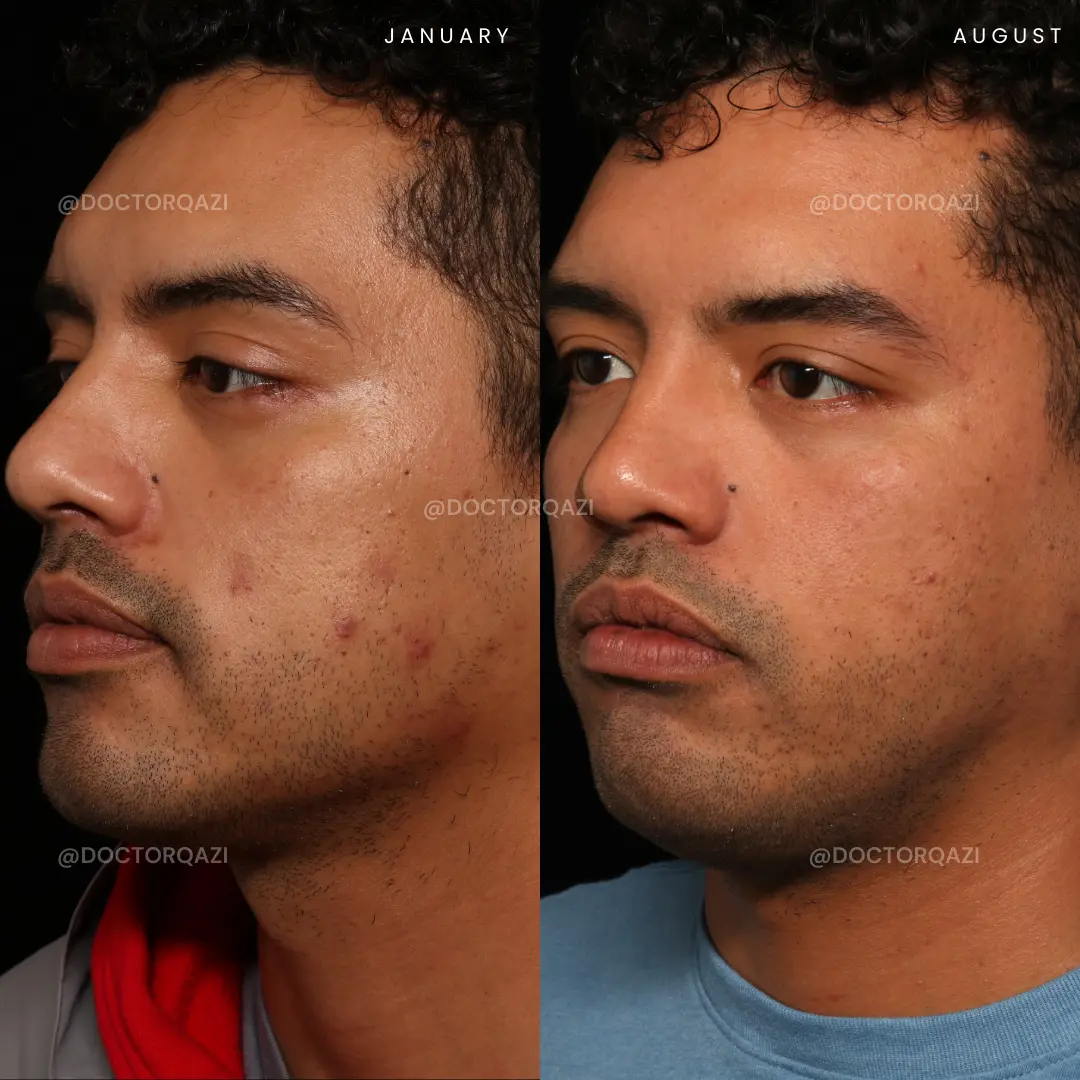 gallery.image.item,13