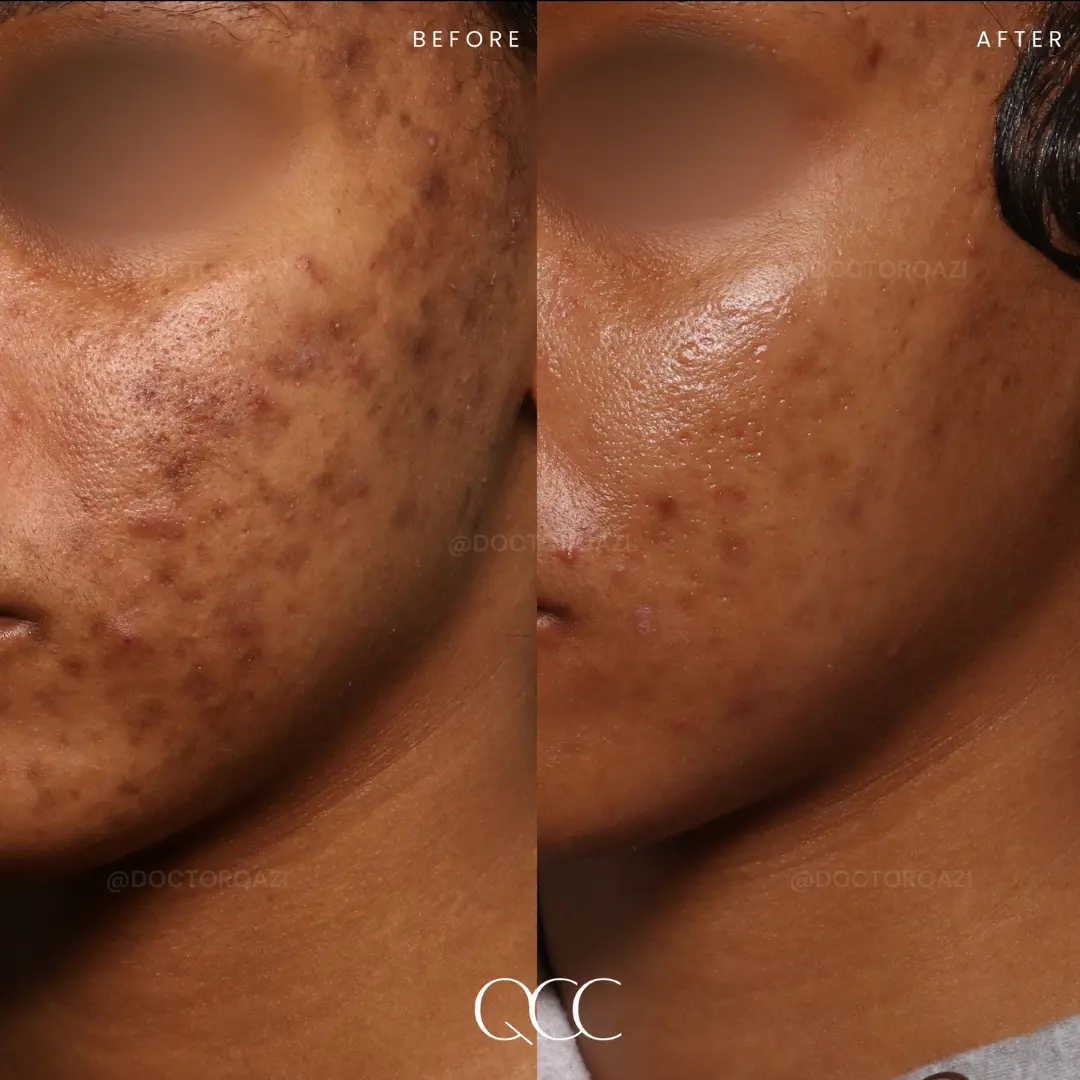 gallery.image.item,14