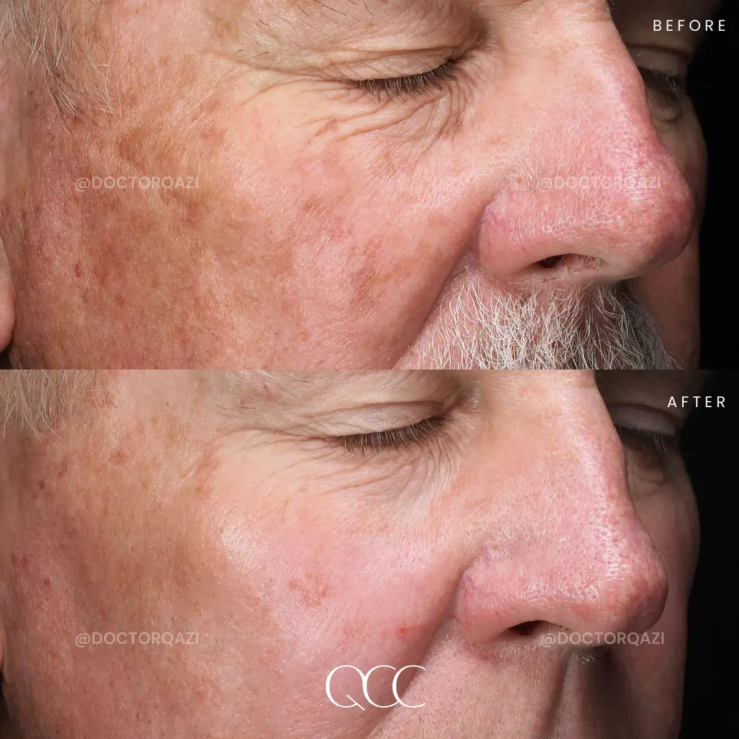 gallery.image.item,25