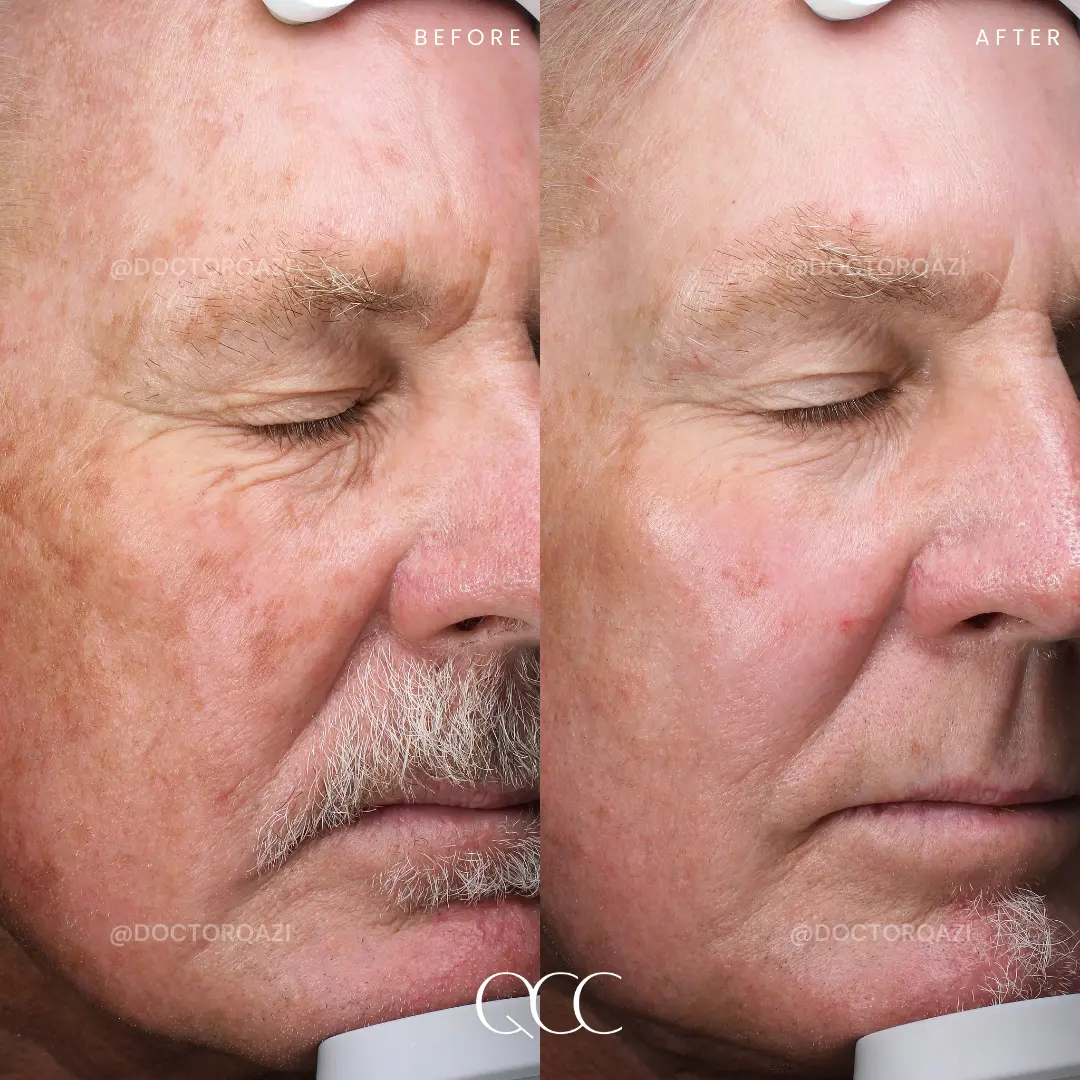 gallery.image.item,26