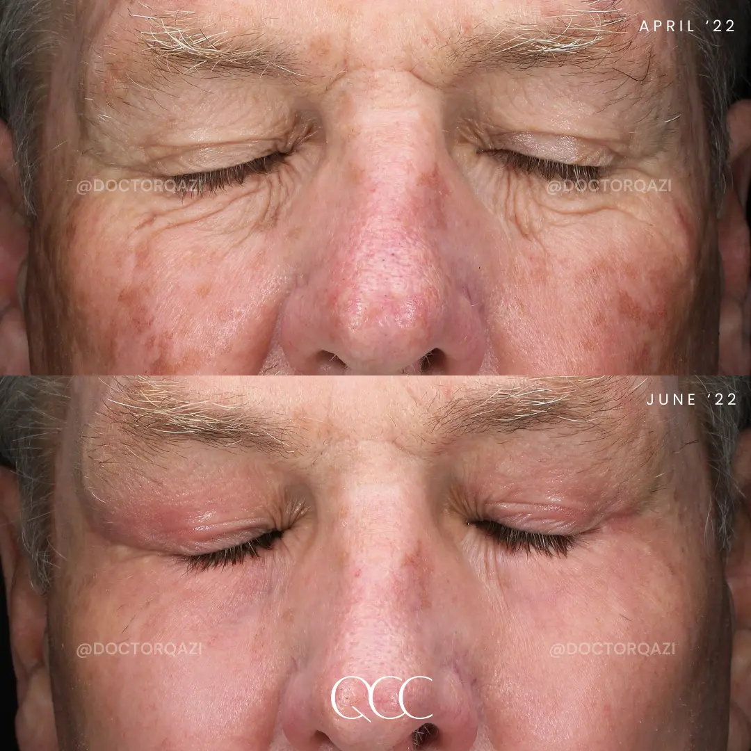 gallery.image.item,29