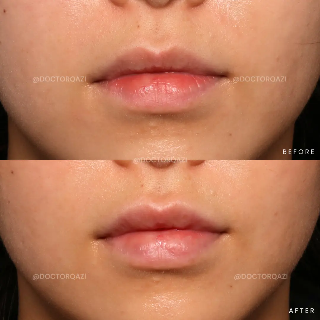 gallery.image.item,30