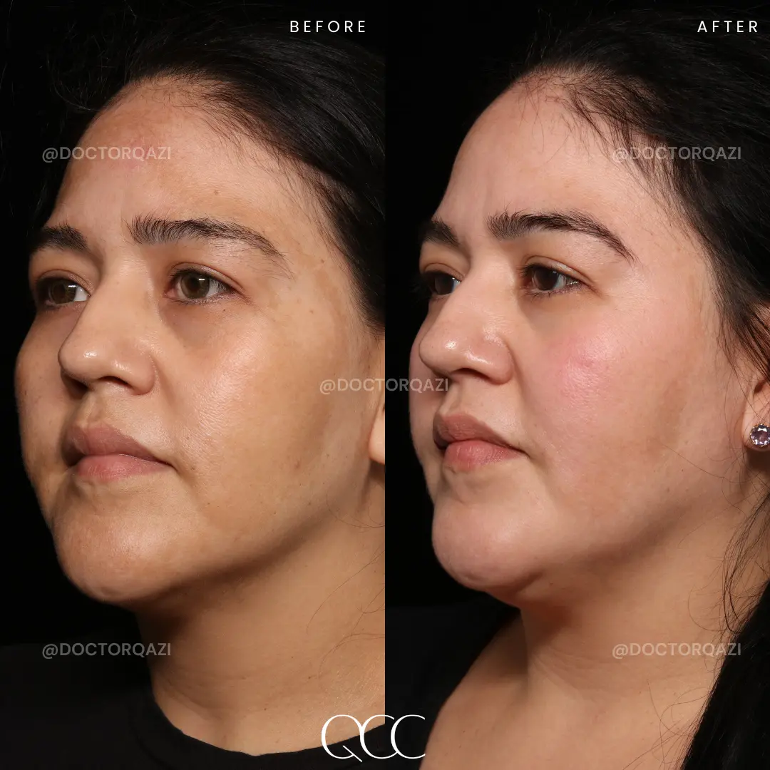 gallery.image.item,45