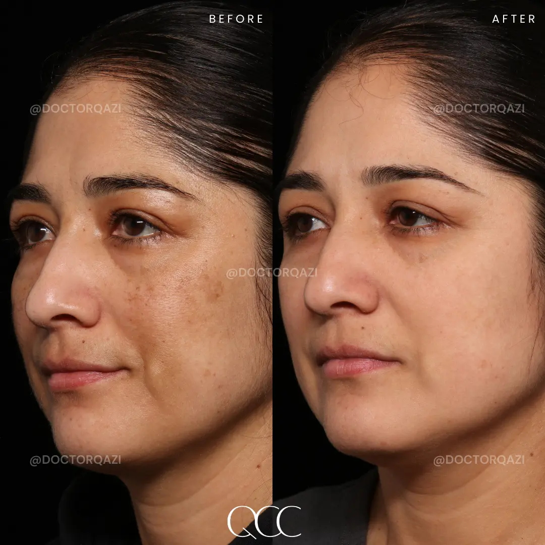 gallery.image.item,58