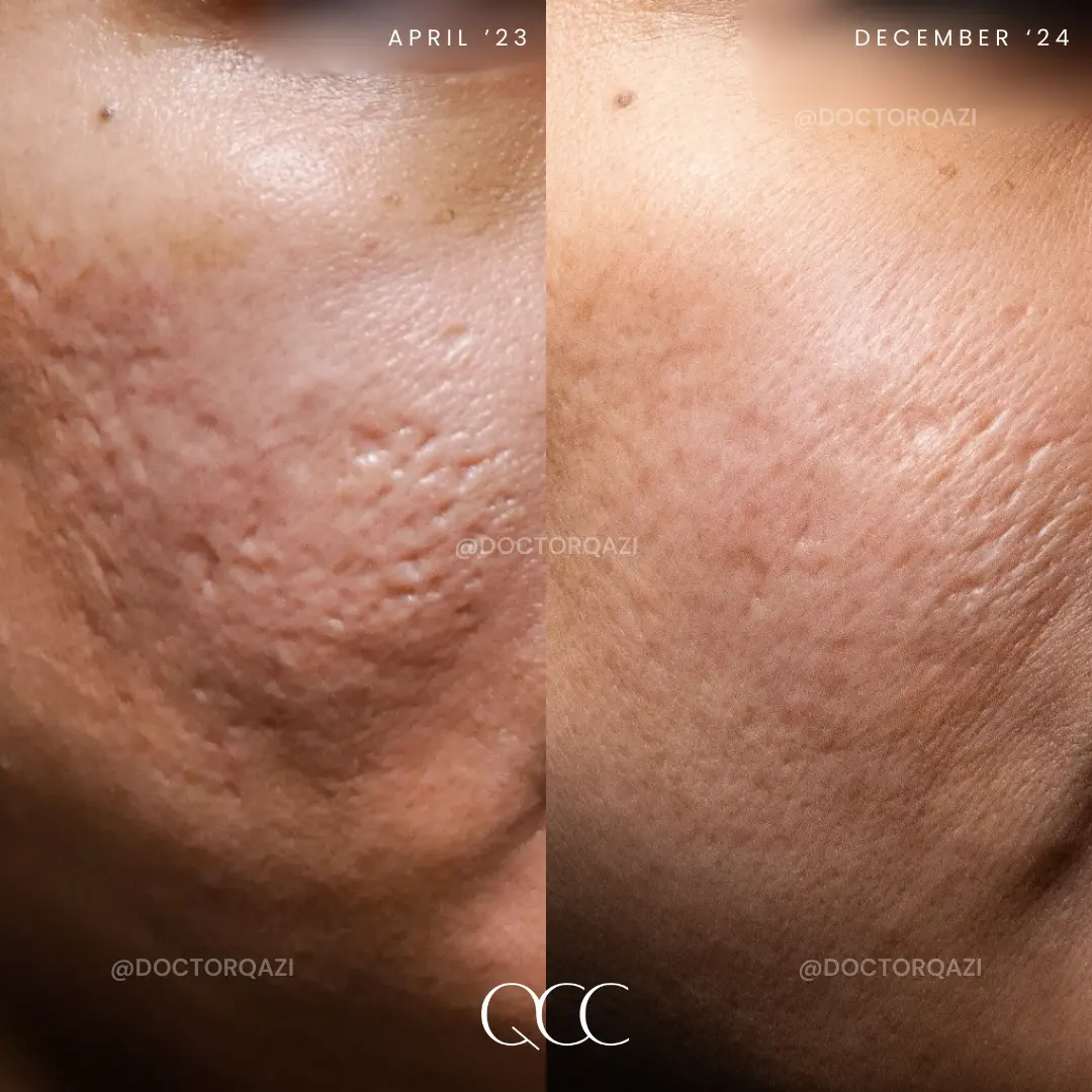 gallery.image.item,72