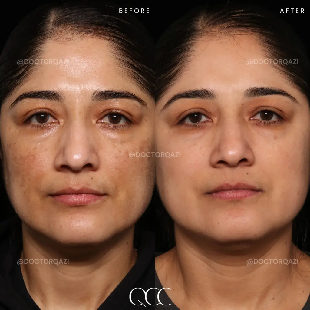 pigmentation 18.webp