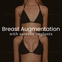 Breast Augmentation with Natrelle Implants
