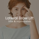 Brow Lift Without General Anesthesia