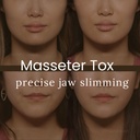 Masseter Tox