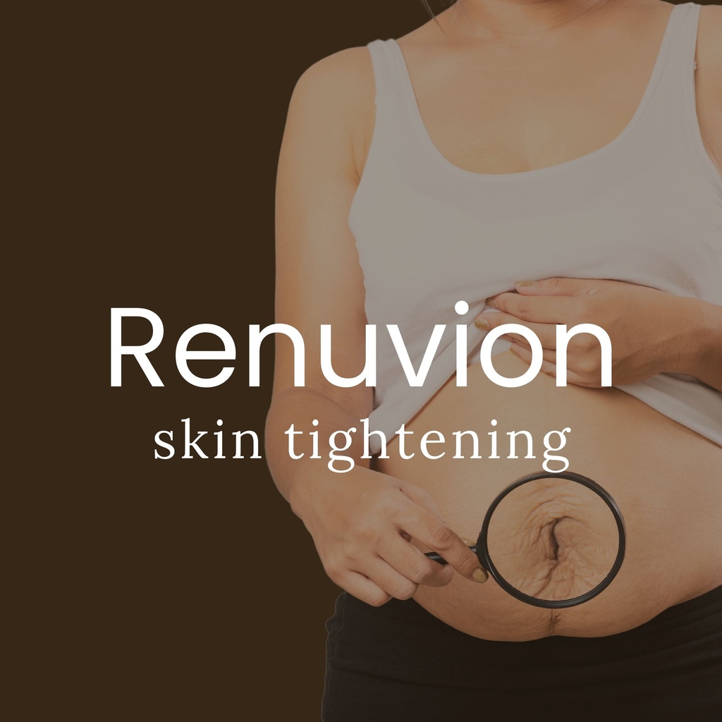 Renuvion for Skin Tightening