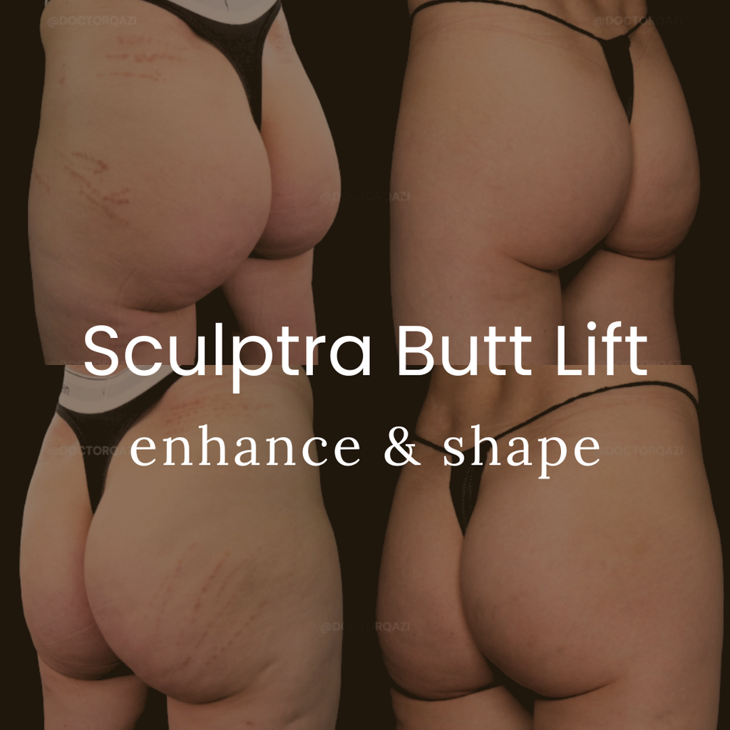 Sculptra Butt Lift Collagen Buttocks Enhancement Without Surgery