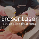 Eraser Laser Treatment