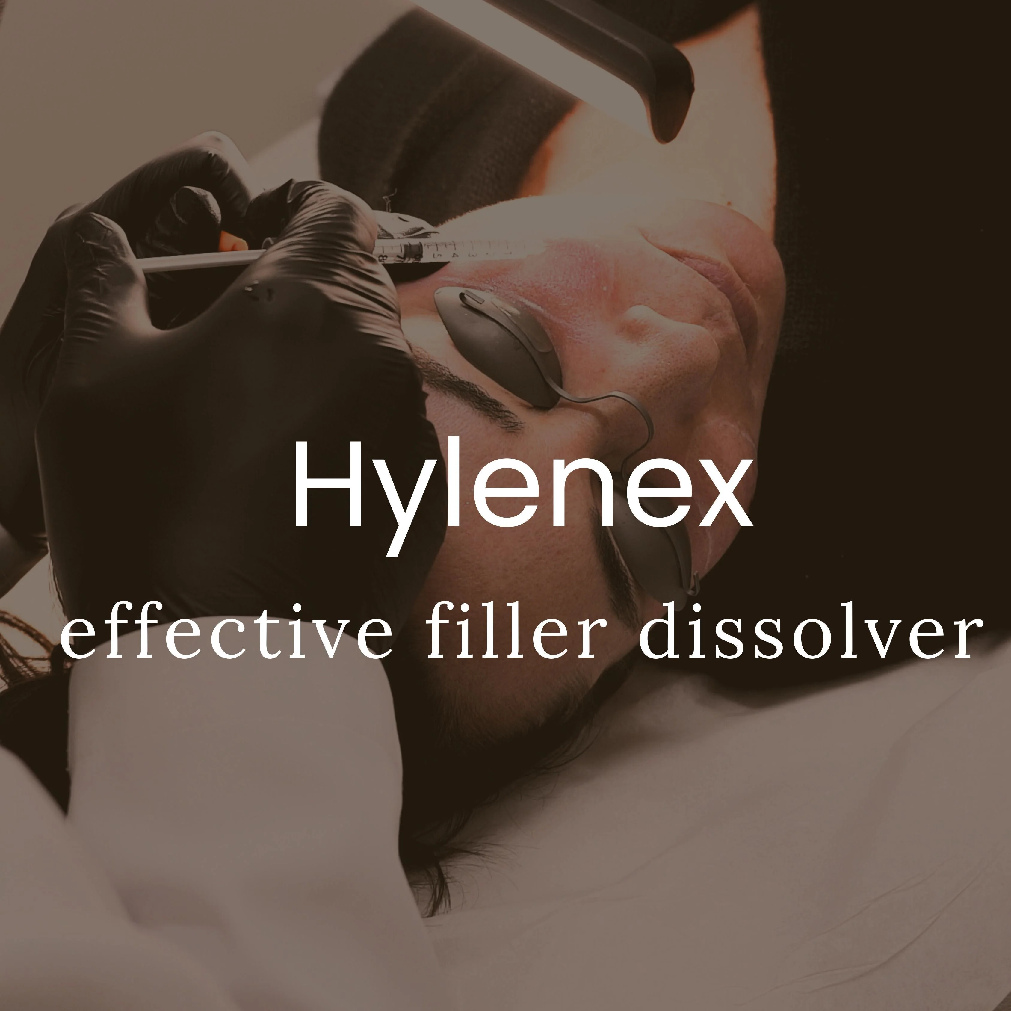Filler Dissolving with Hylenex
