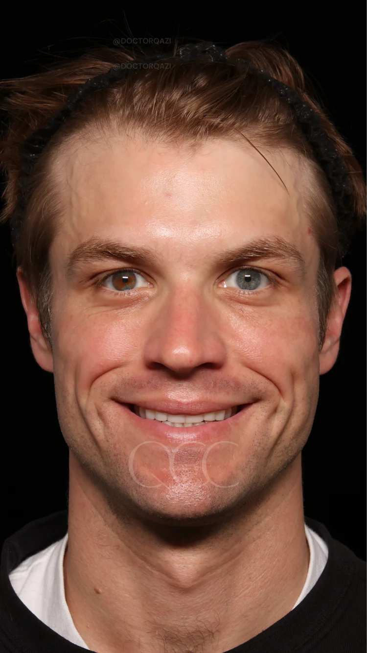 Revisions & Emergencies