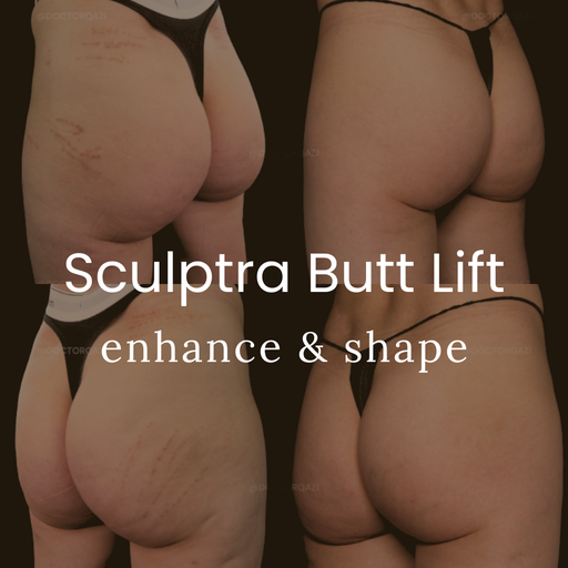 Sculptra Butt Lift Collagen Buttocks Enhancement Without Surgery